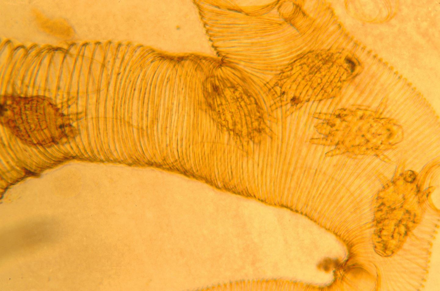 трахеи под микроскопом